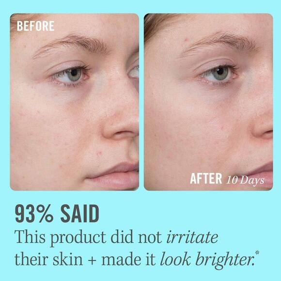 First Aid Beauty 10% Vitamin C Brightening Serum - Picture 2 of 8